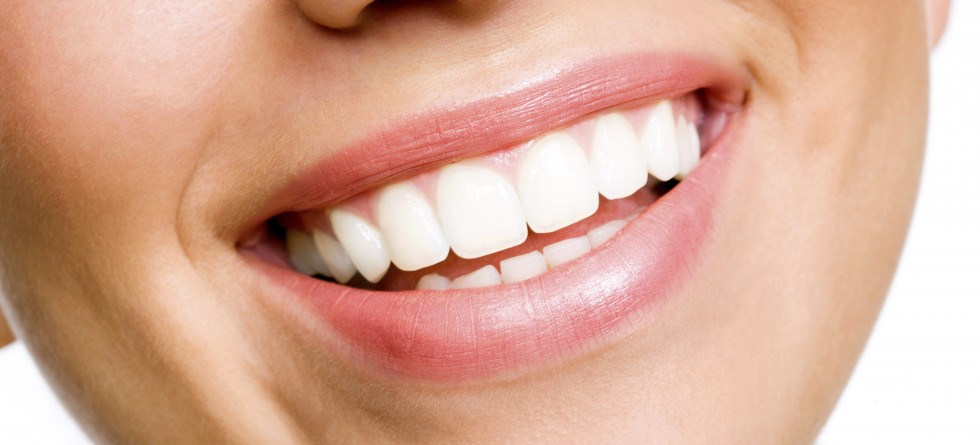 Perfect Smile
