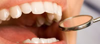 oral-cancer-checkup